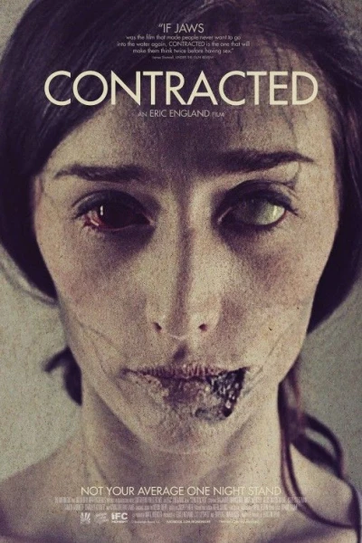 Contracted - Fase I
